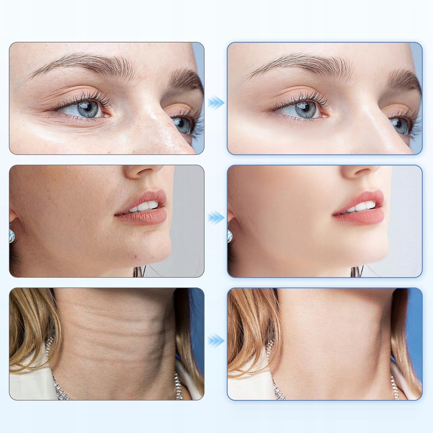 NECK FACE LIFTING MASSAGER SONIC FOR FIRMING VIBRATION EMS Voltage 0 V