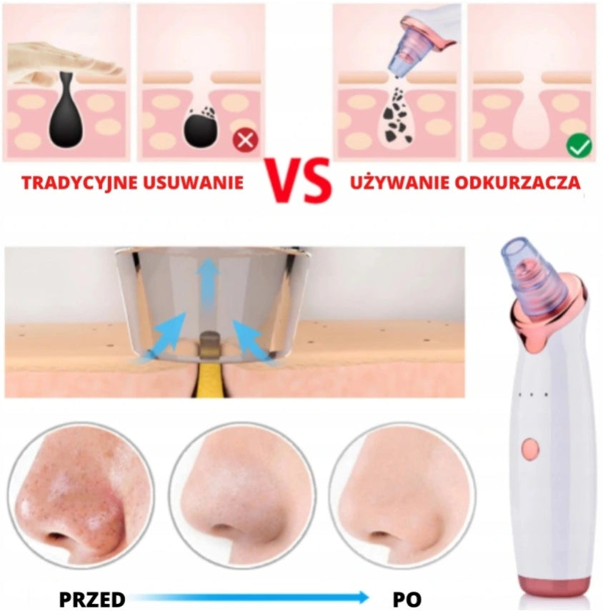ODKURZACZ WĄGRÓW 12w1 MIKRODERMABRAZJA + MASAŻER + Manufacturer code 09182738