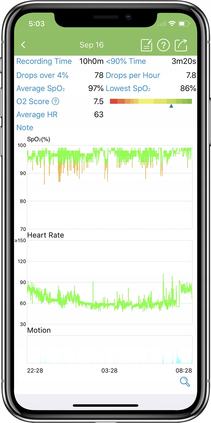 Pulse oximeter Wellue KidsO2 black Medical device yes