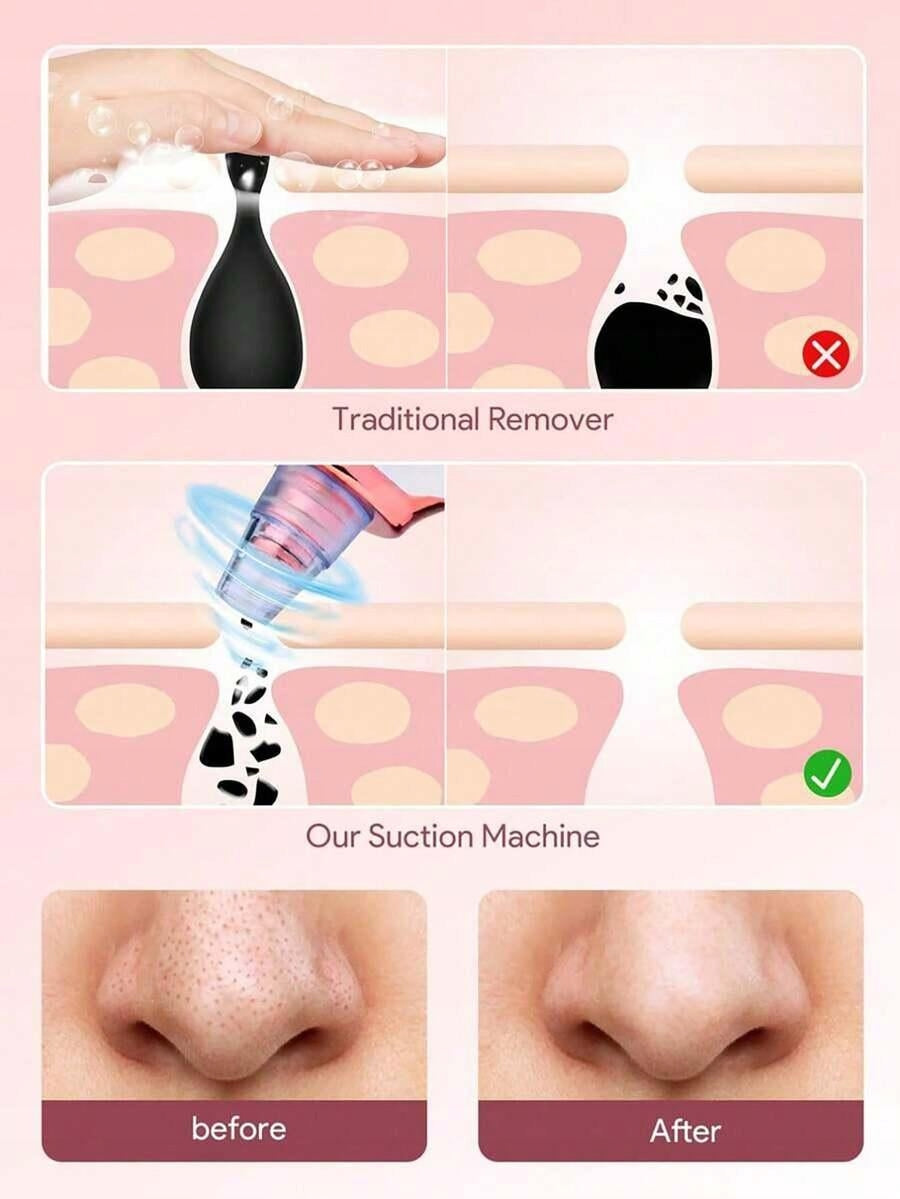 SHEIN ELECTRIC PORE PURIFIER AJV S07 Customs tariff code 85098000