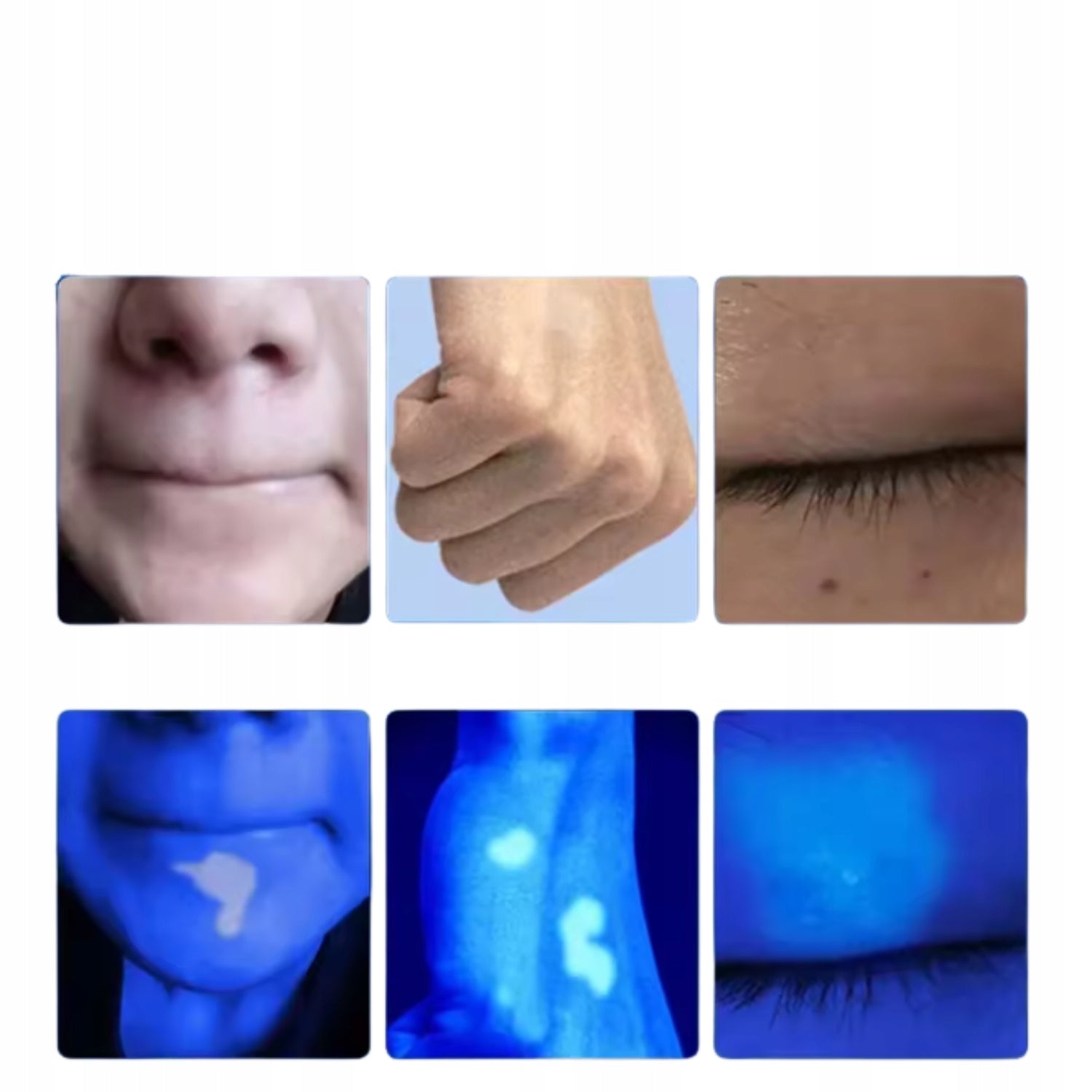 Skin Analyzer with Wood UV Lamp Cosmetic Skin Test Lamp Brand no brand
