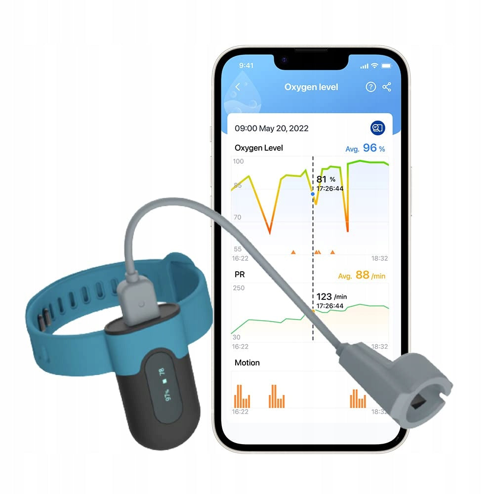 Sleep Monitor Pulse Oximeter. Alarm Vibration, Bluetooth App Results Export