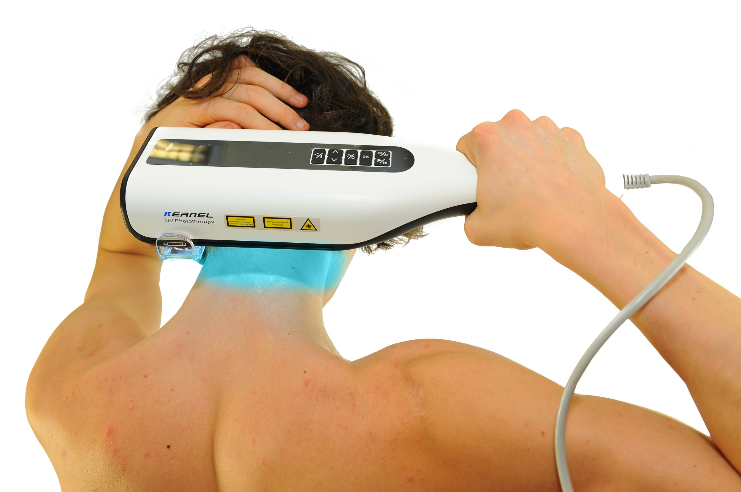 UVB lamp 311nm KERNEL psoriasis vitiligo eczema azs alopecia areata Manufacturer code KN-4006BL1
