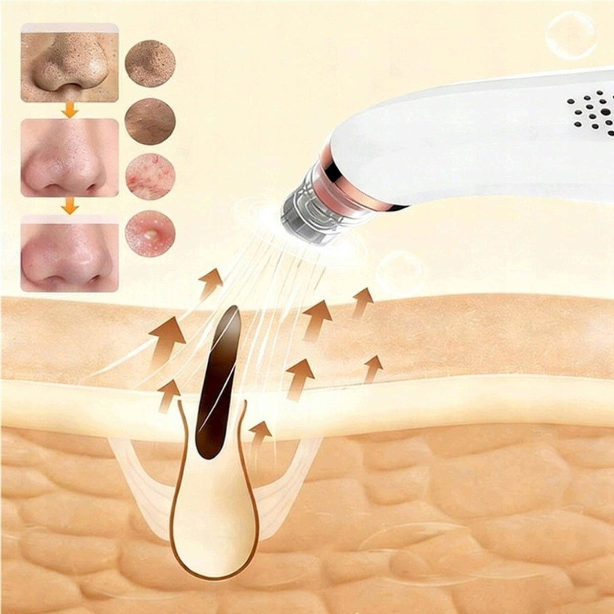 VACUUM CLEANER FOR BLACKHEAD USB FACIAL PORE CLEANSING DEVICE Packaging status original