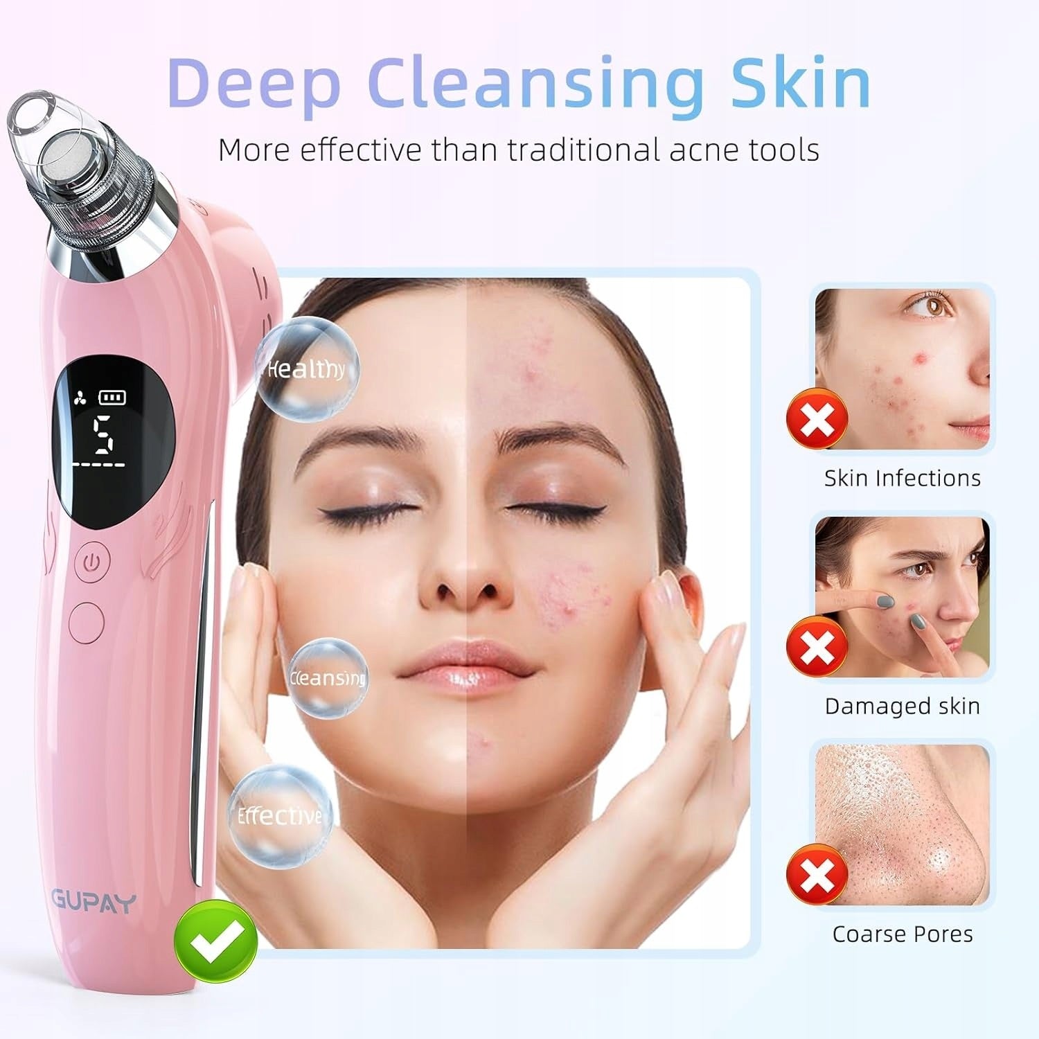 VACUUM CLEANER FOR BLACKHEADS PORES CLEANSING THE FACE FROM SCAVENGERS Batteries included yes