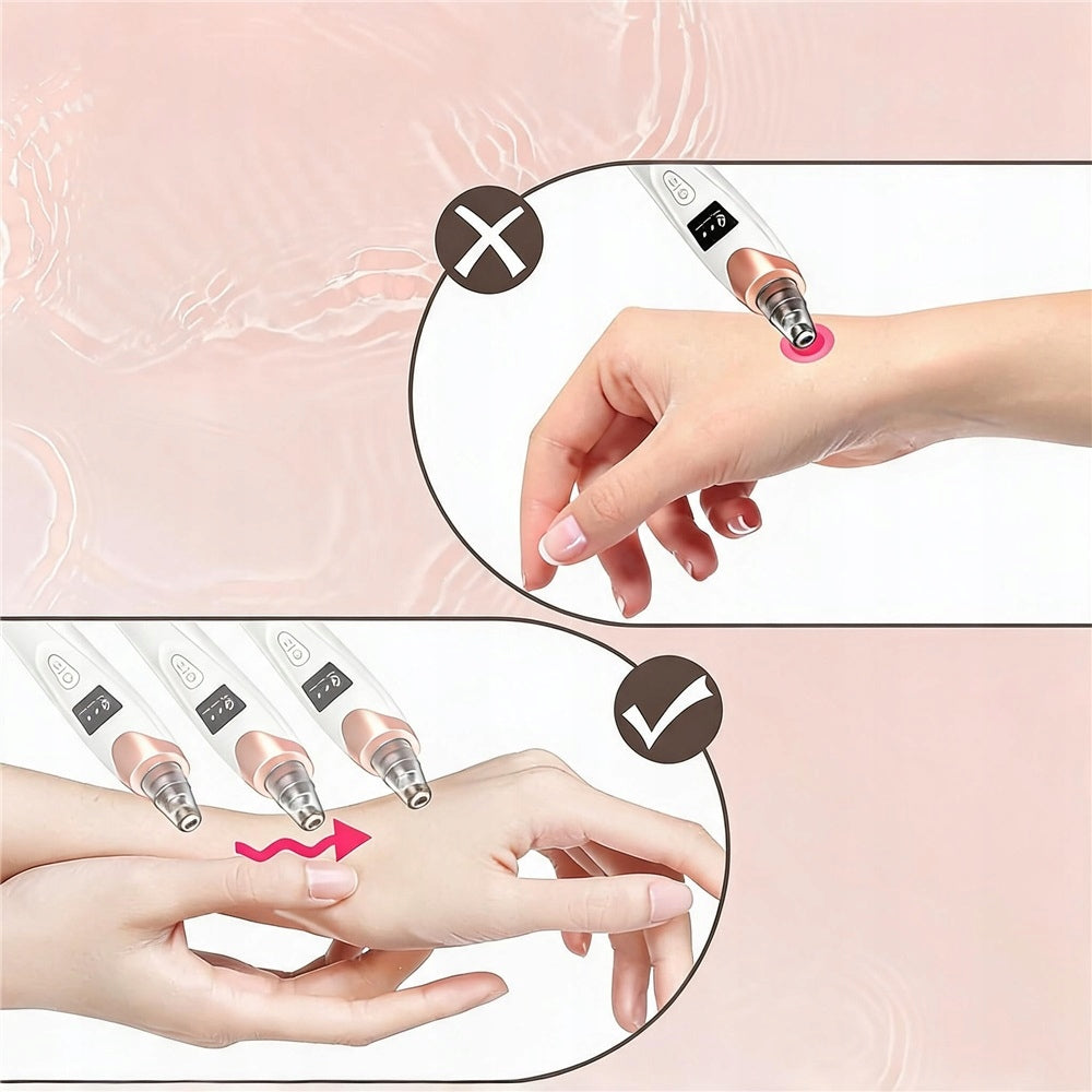 VACUUM CLEANER FOR REMOVING BLACKHEADS PIMPLES 5in1 MICRODERMABRASION Brand no brand