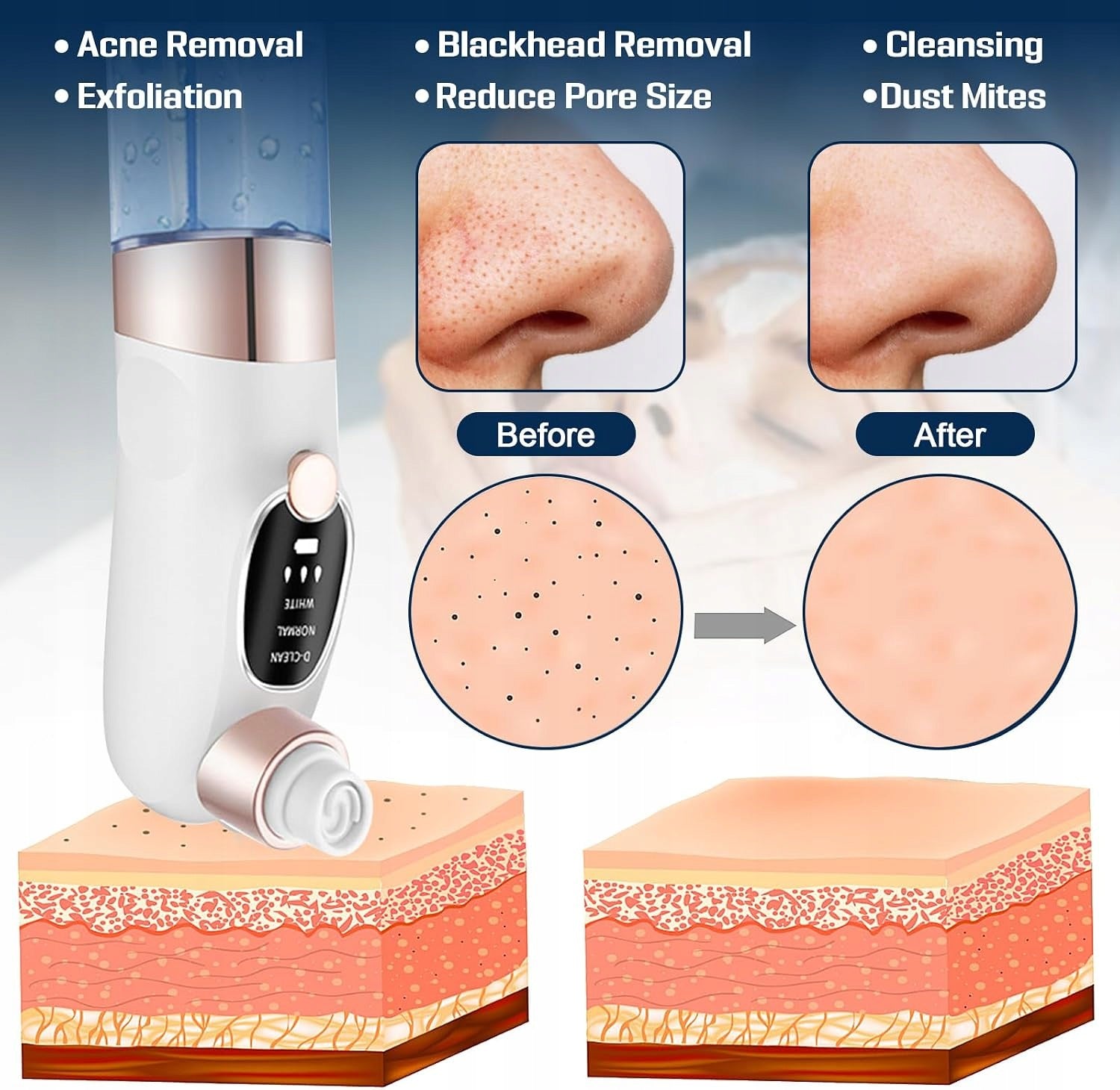 VACUUM PORE CLEANING DEVICE 3 LEVELS 6 SND FACE Brand EA
