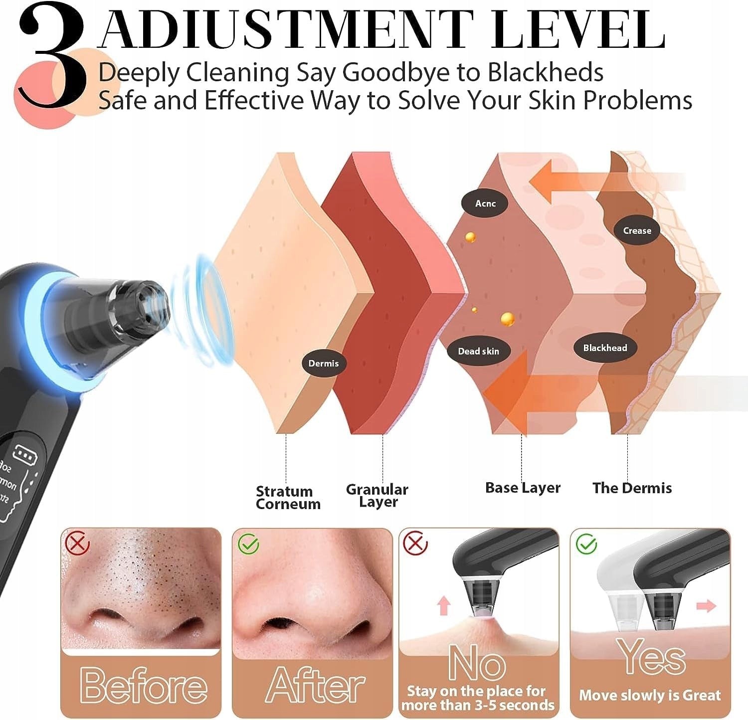 Vacuum Cleaner for LED Blackheads 3 Modes 4 Tips USB Pore Cleaner Packaging status original