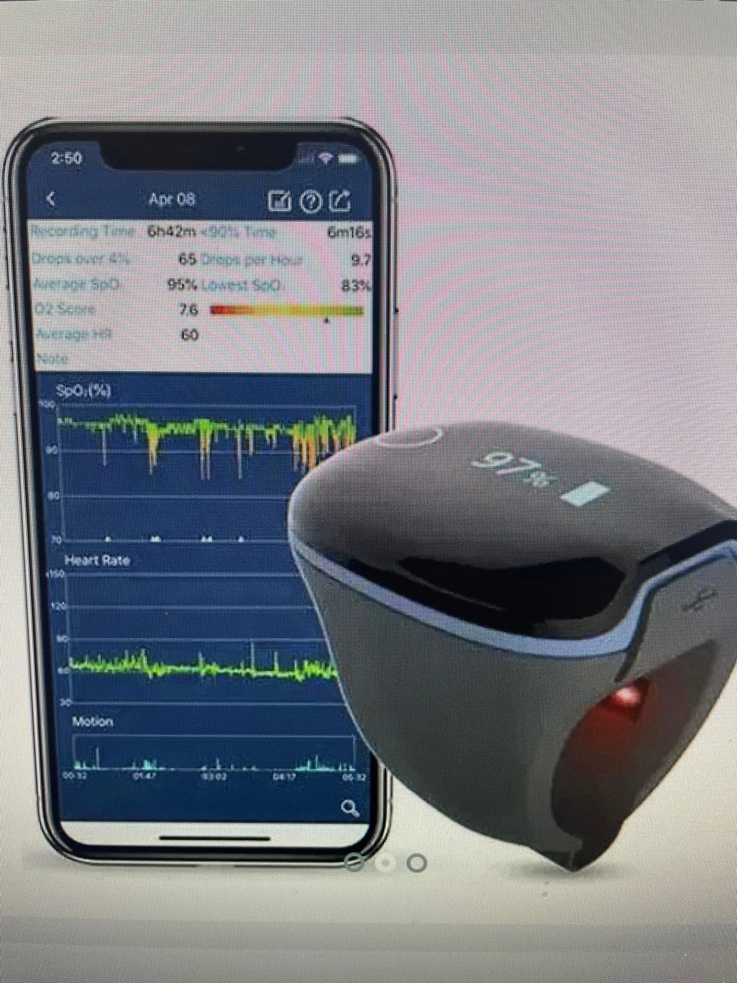 Viatom Wellue O2Ring Wearable Oxygen Monitor