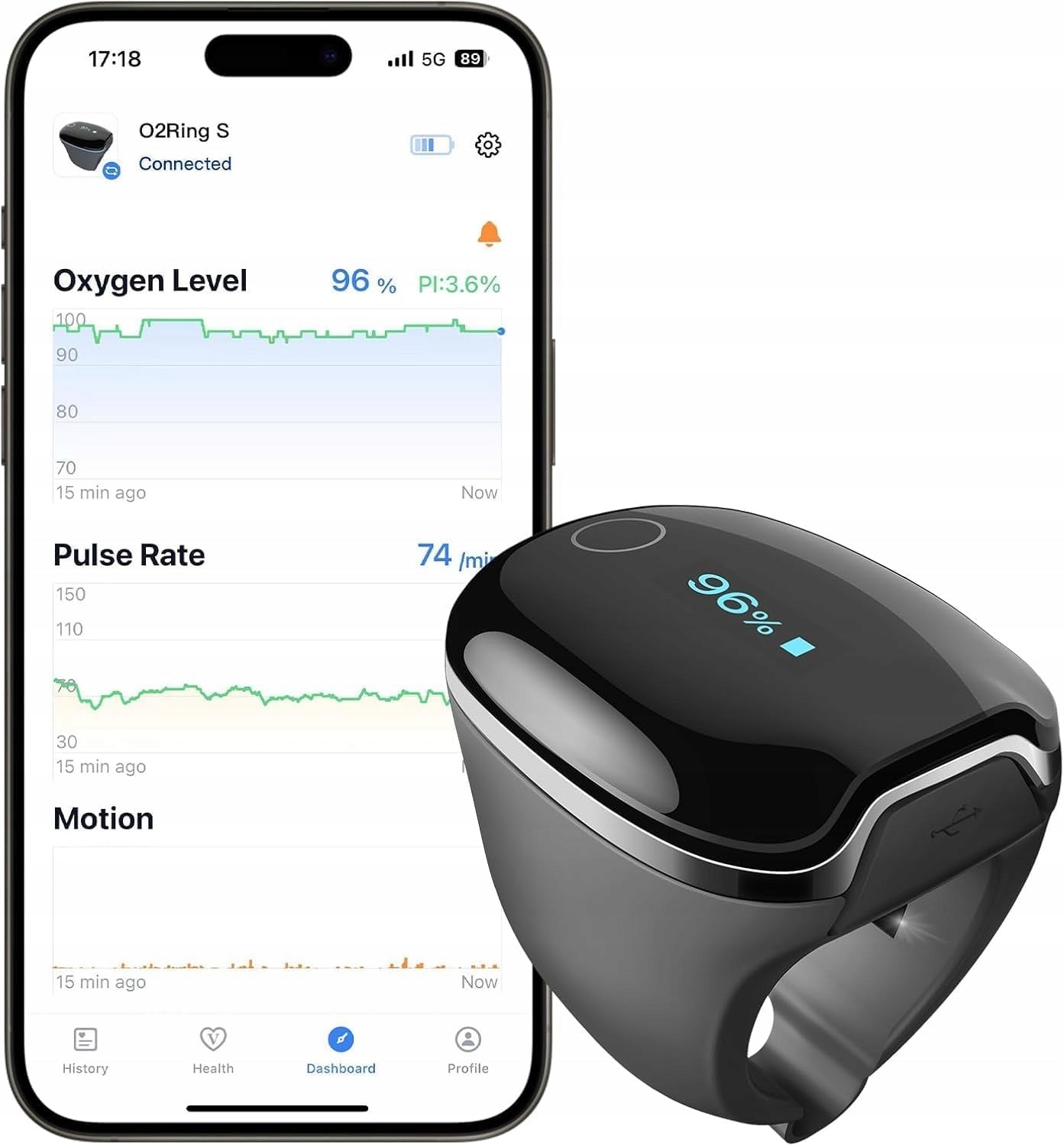 Wellue O2Ring-S Pulse Oximeter Night Sleep Monitor Oxygen Vibration Bluetooth