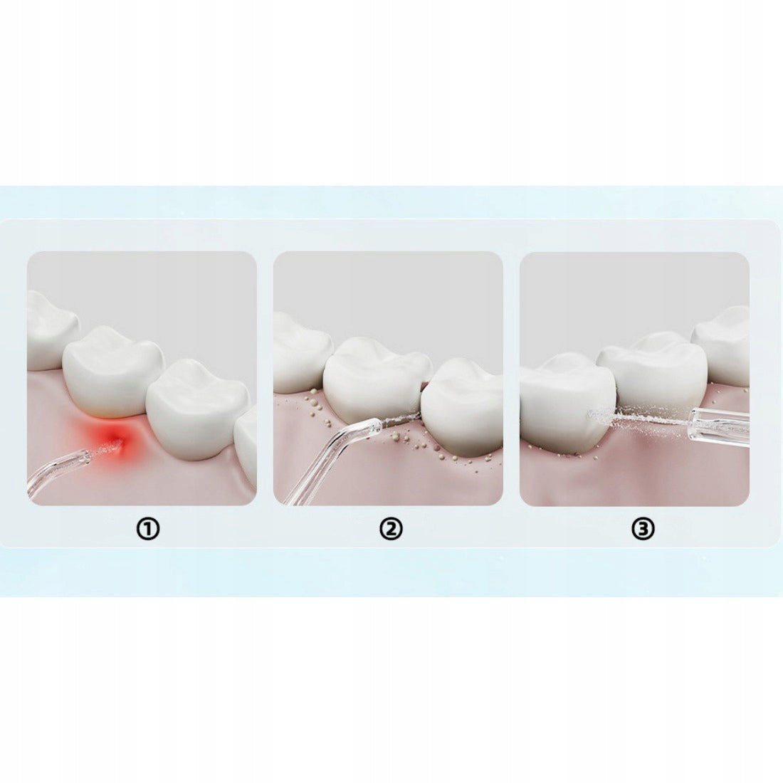 Xiaomi Mi Electric Mouth Irrigator F300 Wireless Cleaning Mouth U Product weight with unit packaging 0.45 kg